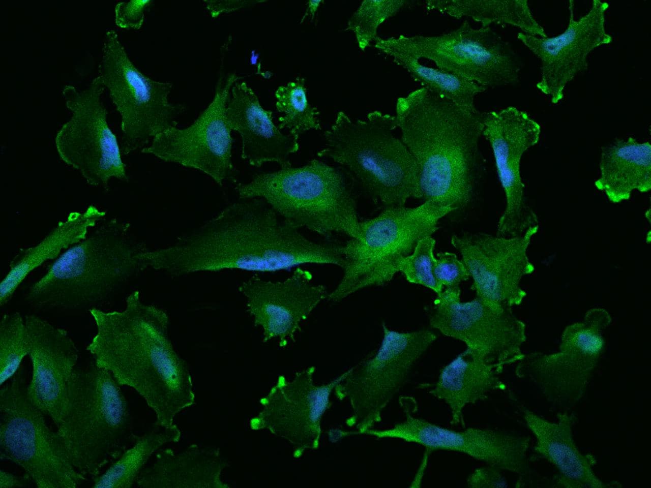 Polyclonal Rabbit anti-Human UCHL1 / PGP9.5 Antibody (IF)