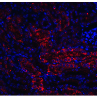 Polyclonal Rabbit anti-Human DDIT4 / REDD1 Antibody (IHC, IF, WB)