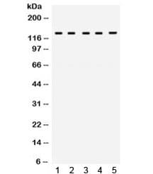 Polyclonal Rabbit anti-Human TRPM8 Antibody (WB)