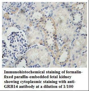 Polyclonal Rabbit anti-Human GRB14 Antibody (aa75-249, IHC, WB)
