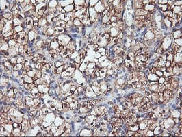PFDN6 / HKE2 Antibody (clone OTI4E10)