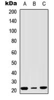 Polyclonal Rabbit anti-Human NSG1 Antibody (Internal, IHC, WB)