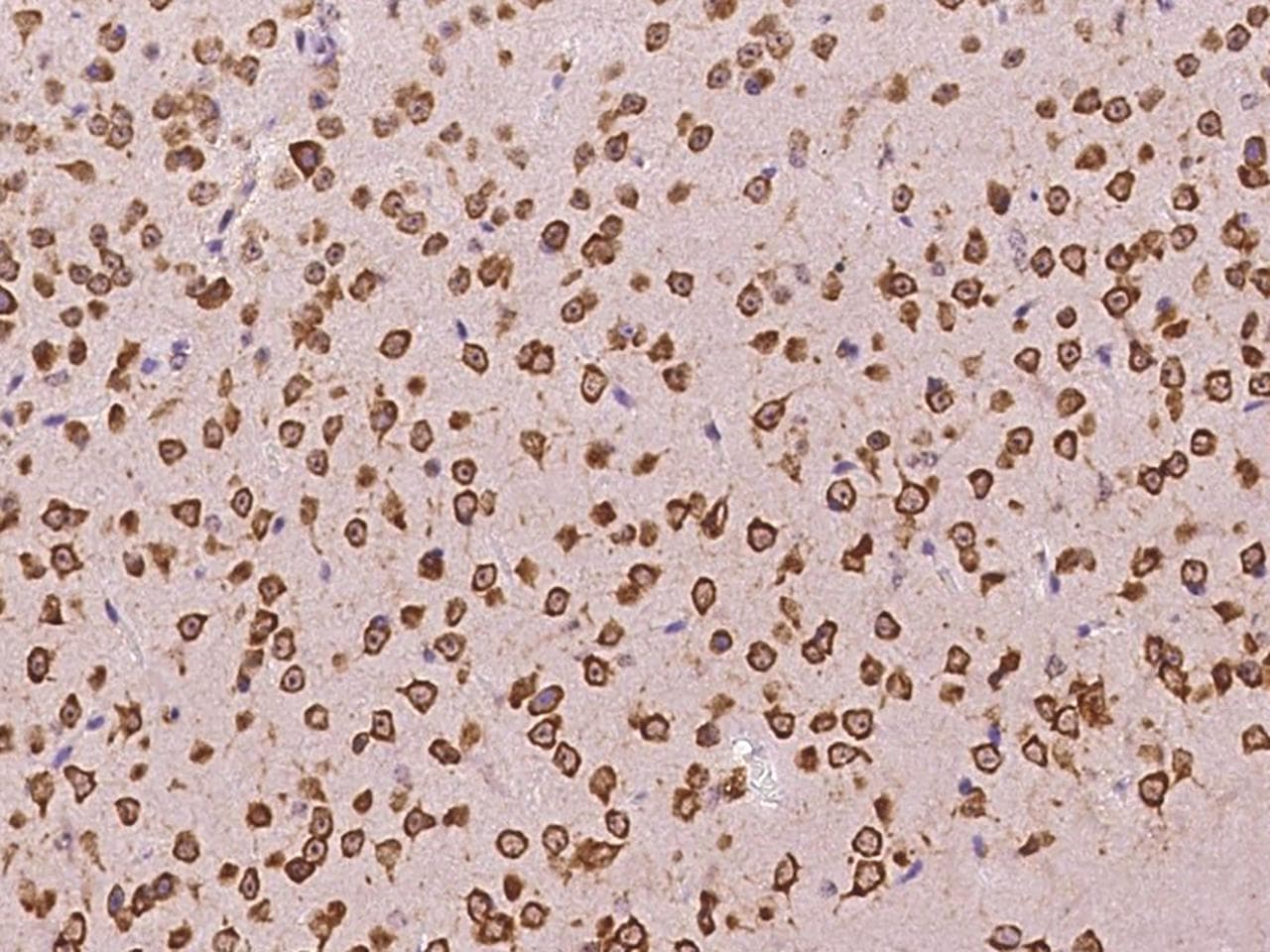 RPS6 / Ribosomal Protein S6 Antibody