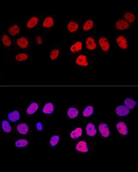 DNMT / DNMT1 Antibody