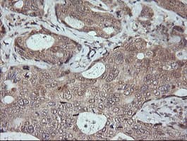 MAPK9 / JNK2 Antibody (clone OTI1A1)