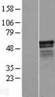 CIPC / KIAA1737 Protein (Over-Expression Lysate Myc-DDK (Flag))