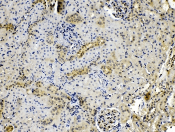 PNP / Nucleoside Phosphorylase Antibody