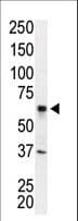 Polyclonal Rabbit anti-Human IRAK2 / IRAK-2 Antibody (aa3-32, WB)