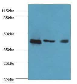 ATXN3 / JOS Antibody (aa1-288)