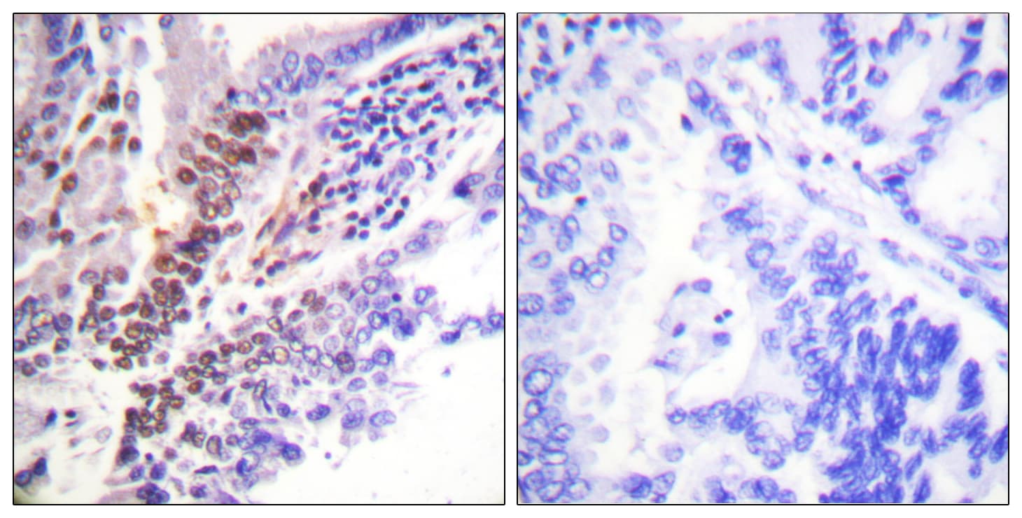 NR3C1/Glucocorticoid Receptor Antibody (phospho-Ser226)