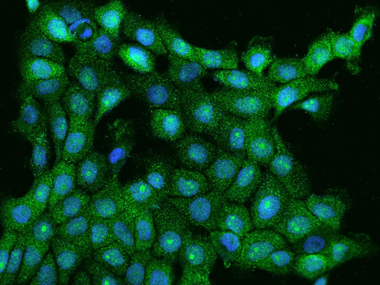 ANKMY1 Antibody