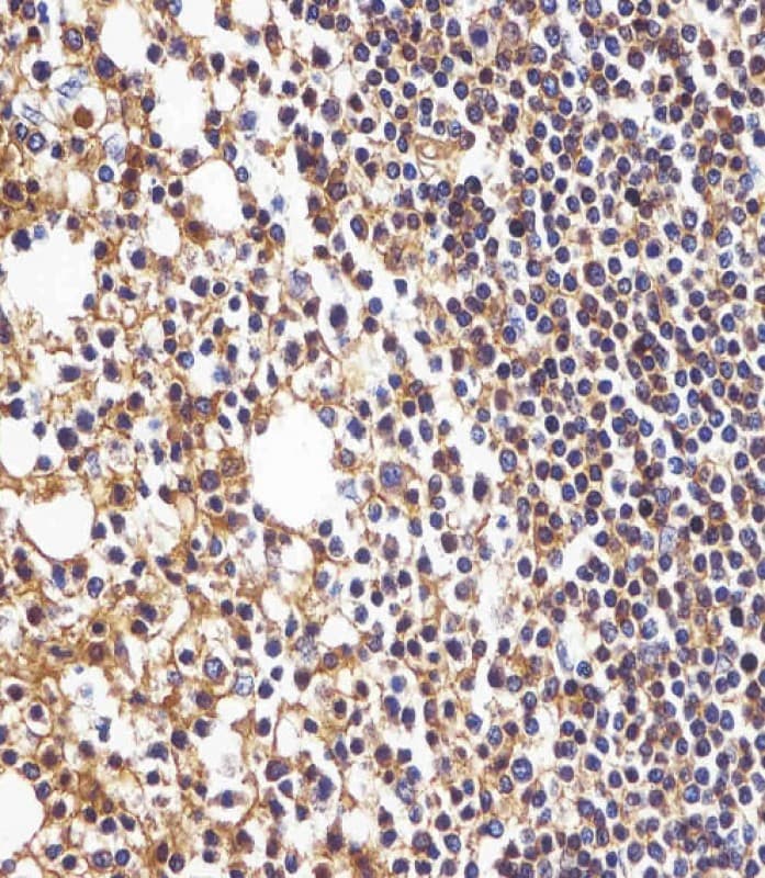 HLA-B Antibody (N-Terminus)