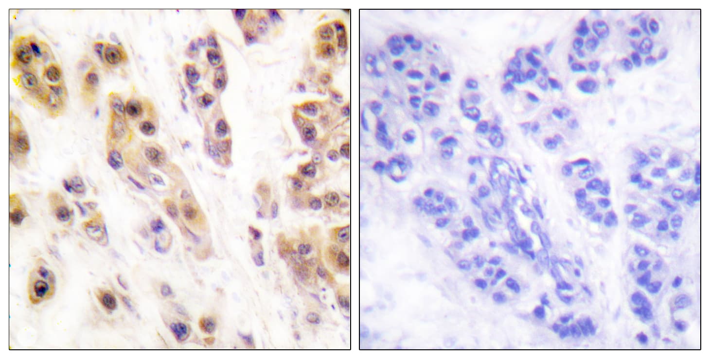 SSB / La Antibody (phospho-Ser366)