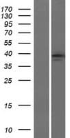 Human PTGER2 / EP2 Protein (Over-Expression Lysate Myc-DDK (Flag))