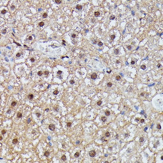 Polyclonal Rabbit anti-Human IGHMBP2 Antibody (IHC)