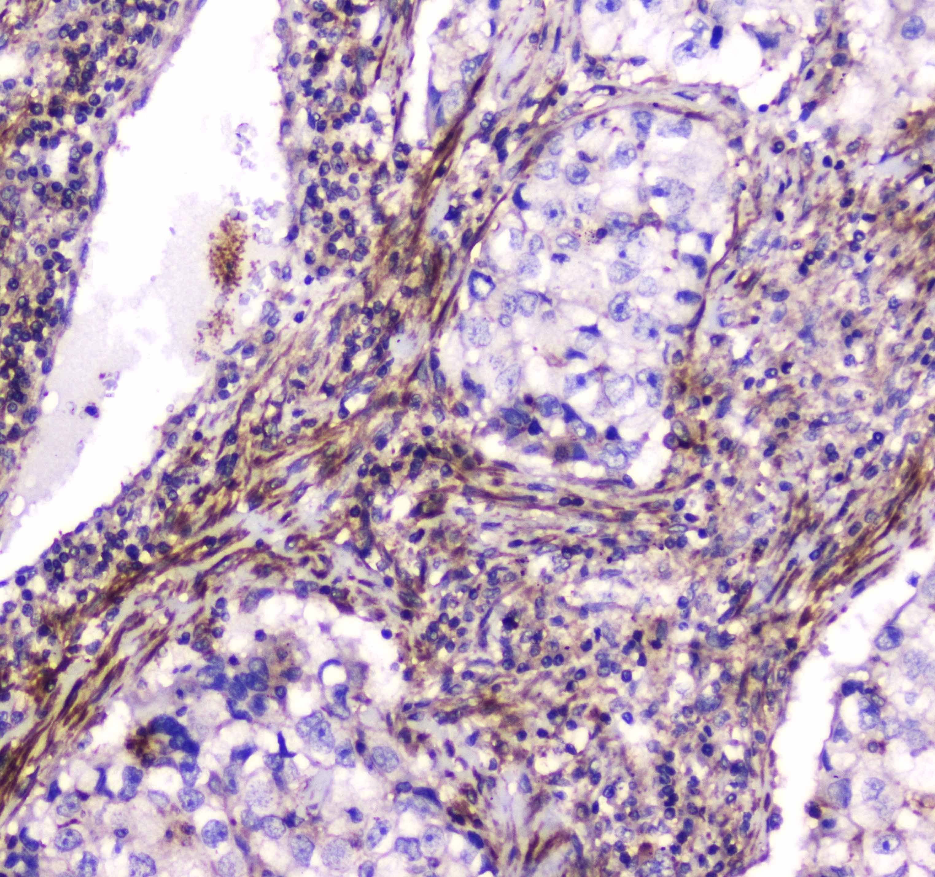 DNM1 / Dynamin Antibody