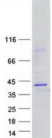 Human CFHR3 / CFHL3 Protein (Recombinant Myc-DDK (Flag))