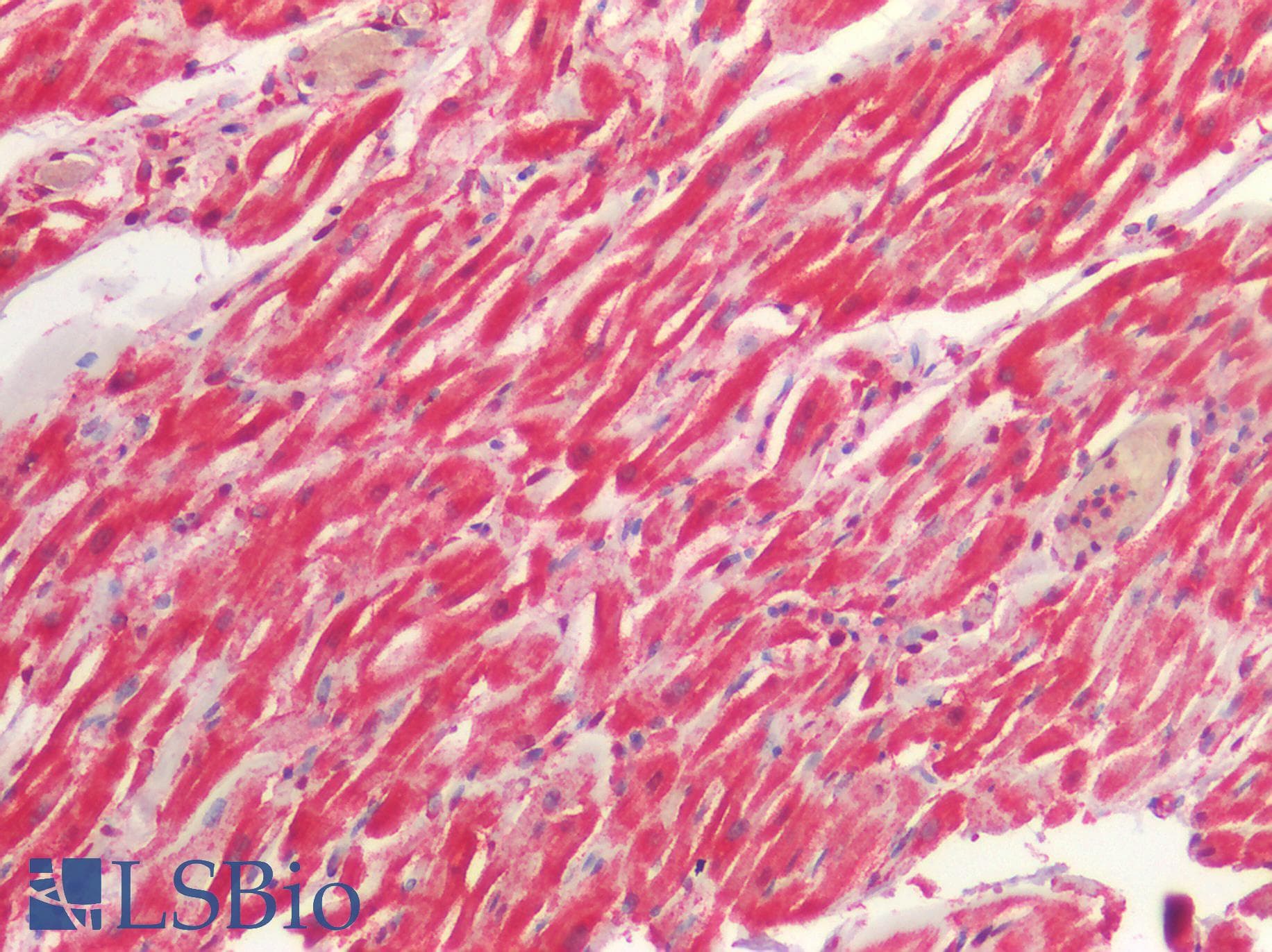 PathPlus™ Polyclonal Rabbit anti-Human BAD Antibody (IHC, WB)