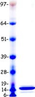 Human SAA1 / SAA / Serum Amyloid A Protein (Recombinant Myc-DDK (Flag))