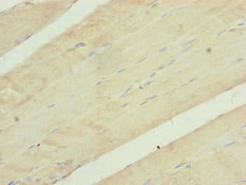 Polyclonal Rabbit anti-Human UQCR10 / UCRC Antibody (IHC)