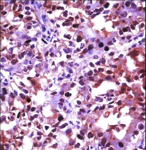 HSF1 Antibody (aa72-100)