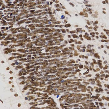 IHC-plus™ Polyclonal Rabbit anti-Human SKIV2L2 Antibody (IHC, WB)