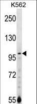 NARG1 / NAA15 Antibody (aa157-185)