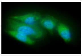 ACOT8 Antibody (clone AT4D10)