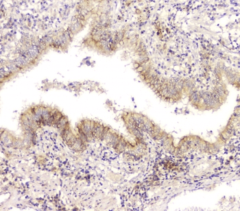 CHM / REP1 Antibody