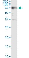 Monoclonal Mouse anti-Human ACD / PTOP Antibody (clone 1D8-1B6, IHC, IF, WB)