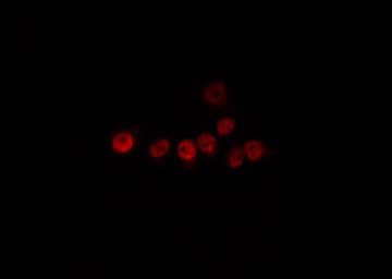 Polyclonal Rabbit anti-Human C/EBP Beta / CEBPB Antibody (IF, WB)
