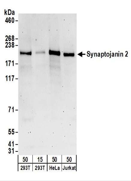 SYNJ2 / Synaptojanin 2 Antibody (aa1446-1496)