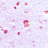 SMAD9 Antibody