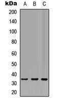 TRADD Antibody (C-Terminus)