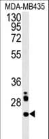 Polyclonal Rabbit anti-Human LHFPL3 Antibody (aa184-213, WB)