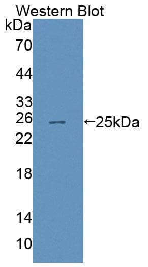 ABCA8 Antibody (PE)