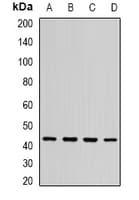 ST3GAL5 / GM3 Synthase Antibody