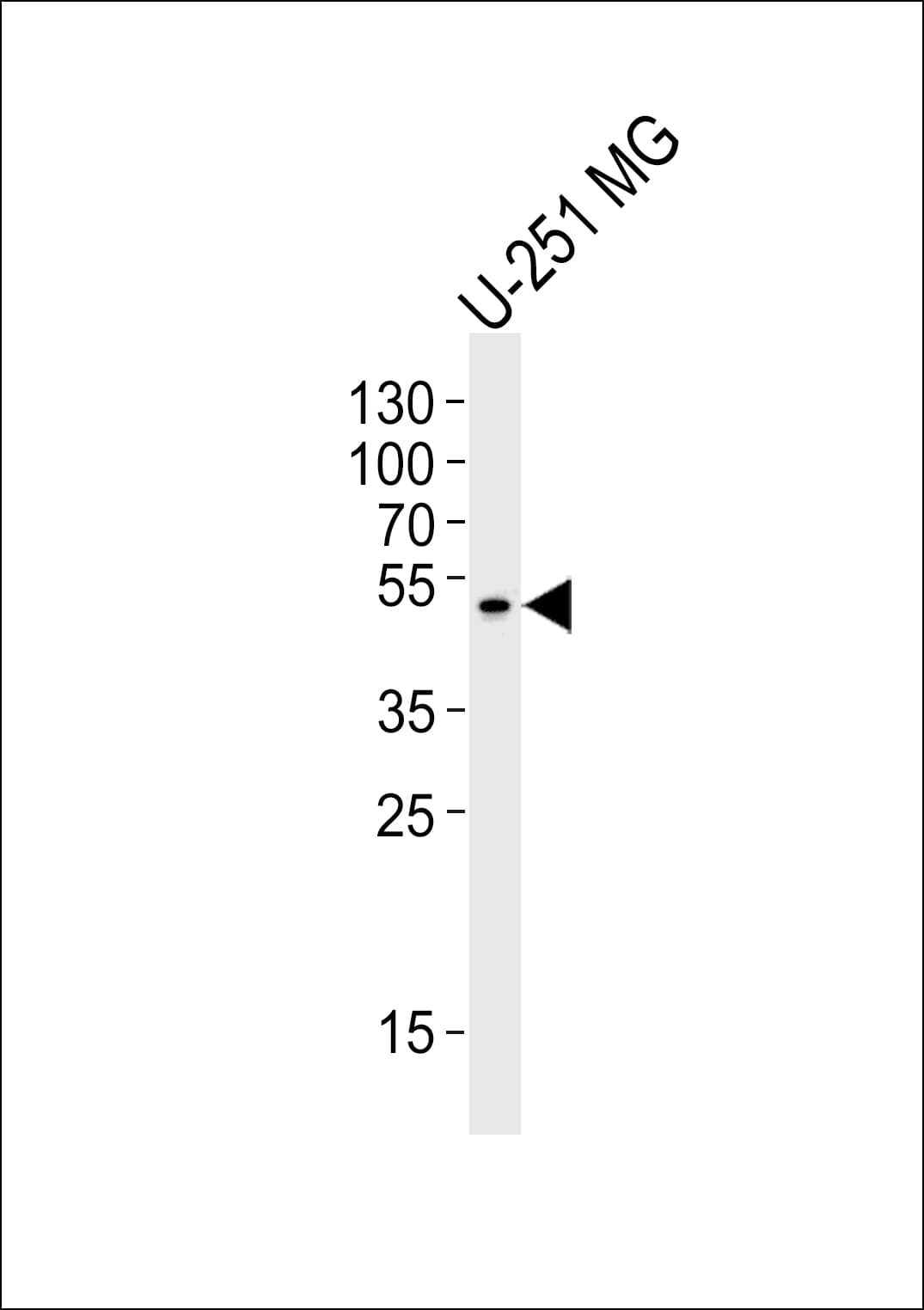 ZNF830 / CCDC16 Antibody (aa173-207)