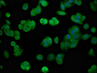 Polyclonal Rabbit anti-Human FGFR4 Antibody (IHC, IF)