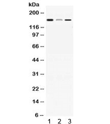 ADAMTS13 Antibody