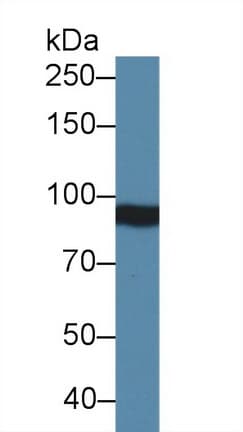 ITGB4 / Integrin Beta 4 Antibody (aa1098-1356)