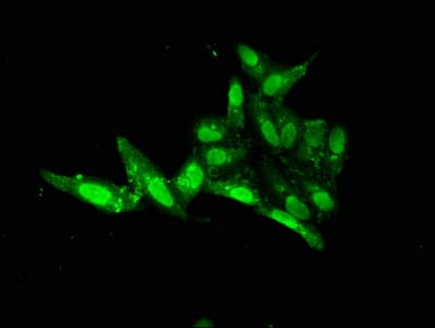 FOXE2 / FOXE1 Antibody