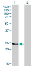 GSTM4-4 / GSTM4 Antibody (clone 4B4)