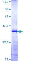 Human WDR11 / PHIP Protein (Recombinant GST, N-terminus)