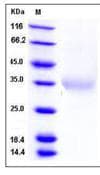 Human IL24 Protein (Recombinant His,C-terminus)