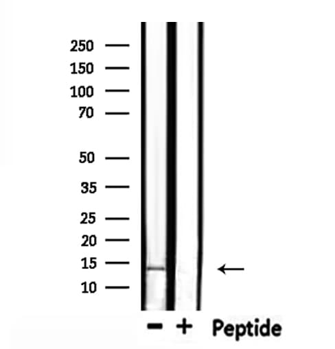 Polyclonal Rabbit anti-Human RABIF Antibody (IHC, IF, WB)