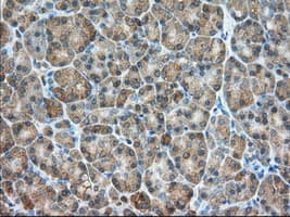 Monoclonal Mouse anti-Human PDE4A / PDE4 Antibody (clone OTI2G2, IHC, IF, WB)