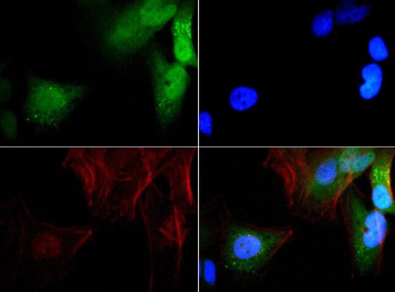GABARAP Antibody (DY650)