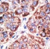 TLR6 Antibody (aa1-30)