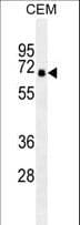 Monoclonal Mouse anti-Human PRKAA2 / AMPK Alpha 2 Antibody (IF, WB)